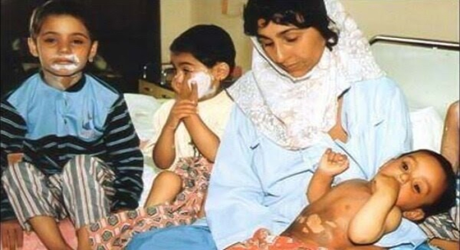 سەردەشت؛ ٣٧ ساڵ بەسەر یەکەمین کیمیابارانی شارێکی جیهاندا تێدەپەڕێت
